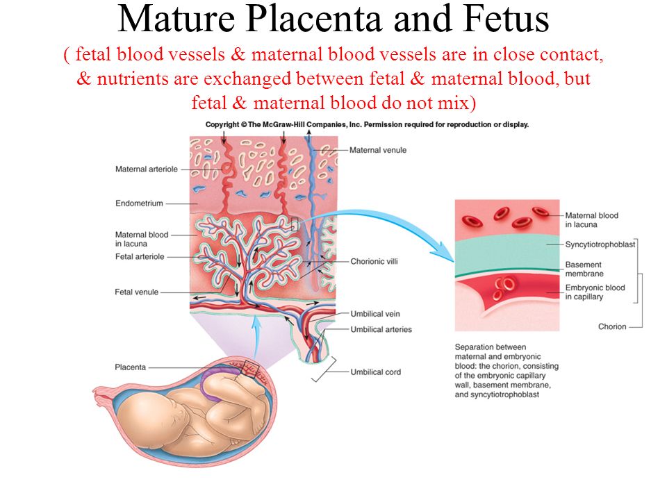 Bilobed placenta gestational diabetes birkin bags better investing